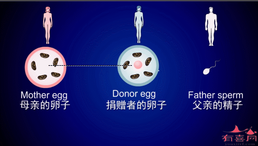 试管代怀双胞胎监护权之争_试管双胞胎监护权之争