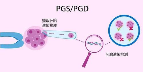 试管代怀怎么做的【试管代怀怎么做？全面解析试管代怀孕的流程及注意事项】