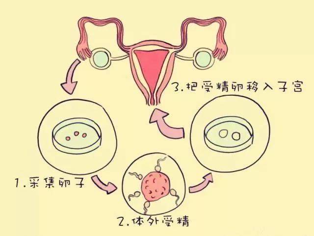 试管代怀可以选性别吗-试管代怀孕是否可以选择宝宝的性别?