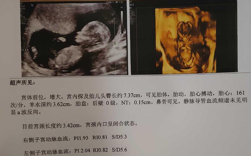 上海三代供卵试管男孩-上海三代供卵试管男孩的成长故事